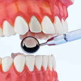 Dent dévitalisée ou nécrosée